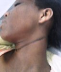 25 yo woman hanged herself 180313.jpg